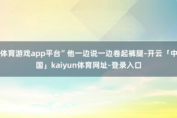 体育游戏app平台”他一边说一边卷起裤腿-开云「中国」kaiyun体育网址-登录入口